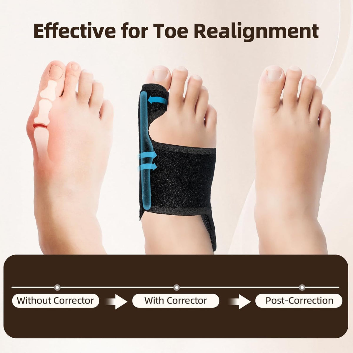 Nighttime Adjustable Bunion Corrector, Splint - Big Toe Straightener
