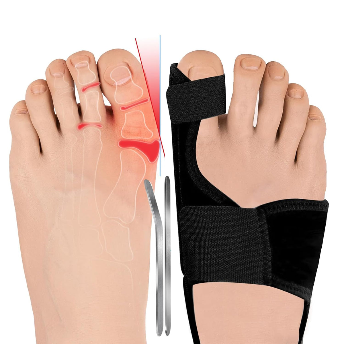 Premium Nighttime Adjustable Bunion Corrector, Splint &amp; Straightener
