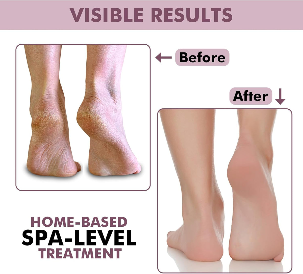Silicone Gel Moisturizing Socks and Protector - Gel, Silicone Sock